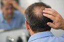 What Causes Thinning at Crown?