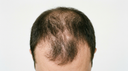 Image before