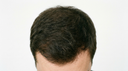 Image after